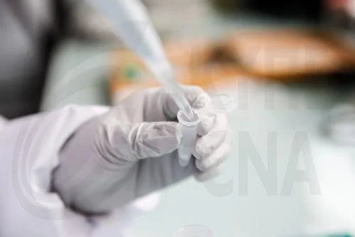 Εντός εβδομάδας αποτελέσματα για πηγή μικροβίου λεγεωνέλλας, λέει στο ΚΥΠΕ ο Δρ. Μενδρής